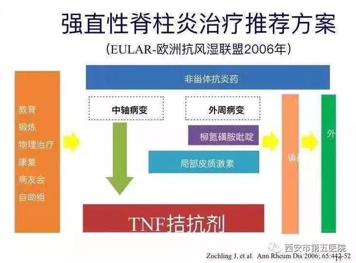 強直性脊柱炎最新研究進展概述